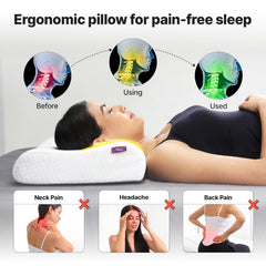 Ultimate Cervical Neck Pillow For Pain Relief Sleep, Butterfly Deign - White | Improves Posture, Neck Pain Relief Cushion With Ultra Responsive Memory Foam & Skin Friendly Cover